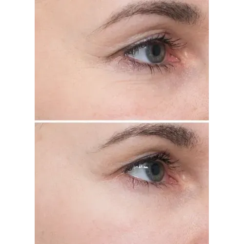 INSTYTUTUM Подушечки з кислотами для глибокого відновлення шкіри Flawless Pads 60шт